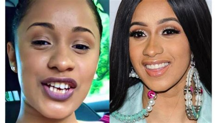 Cardi B's Teeth Transformation: Unveiling Her Smile's Journey
