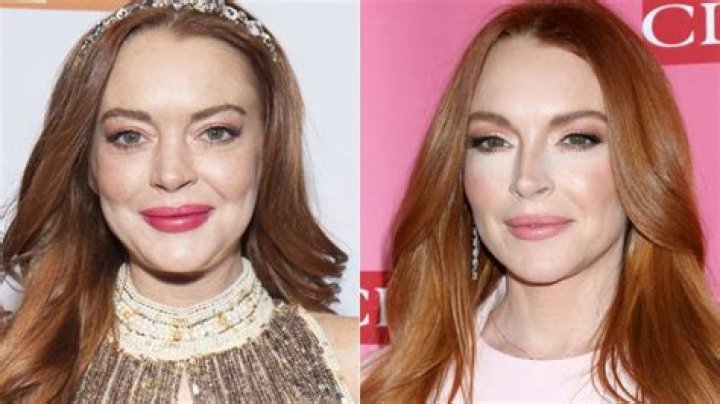 Lindsay Lohan's Plastic Surgery Journey: Uncovering Truths And Lessons